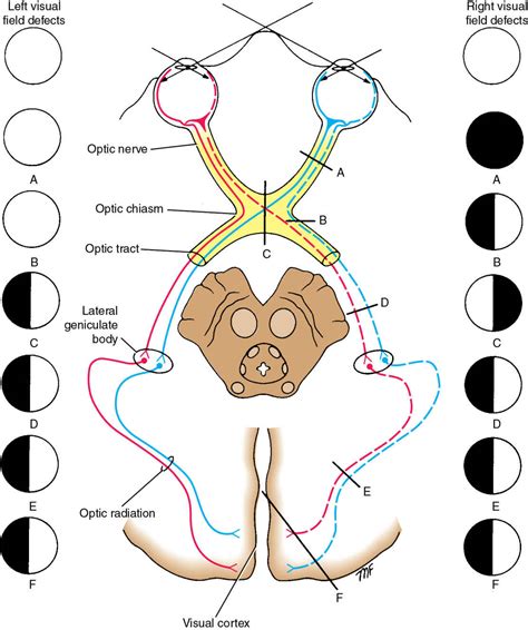 Neuroanatomy, Cranial Nerve 2 (Optic)